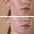 DERMATOLOŠKE INFORMACIJE!