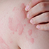 DERMATOLOŠKE INFORMACIJE!